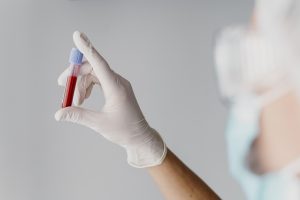 gıda intolerans testi